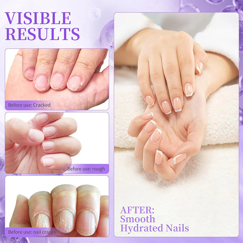 NailSoothe – Nærende neglebåndsskyveroljepenn